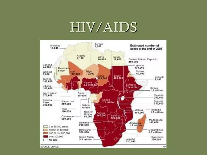 hiv aids