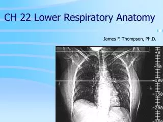 CH 22 Lower Respiratory Anatomy