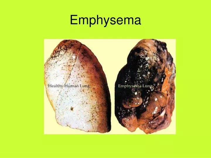 emphysema