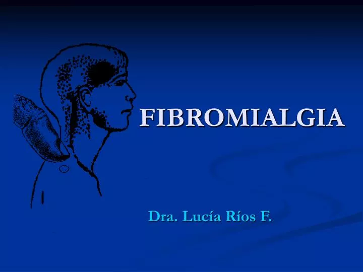 fibromialgia