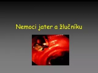nemoci jater a lu n ku