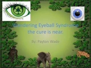 Wandering Eyeball Syndrome the cure is near.