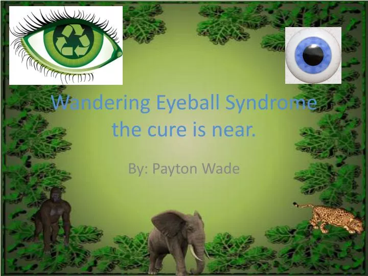 wandering eyeball syndrome the cure is near