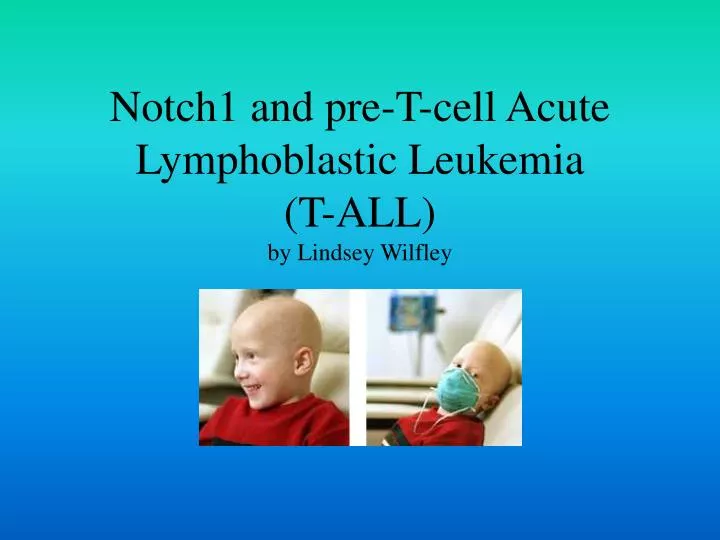 notch1 and pre t cell acute lymphoblastic leukemia t all by lindsey wilfley