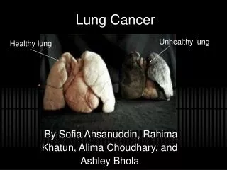 Lung Cancer