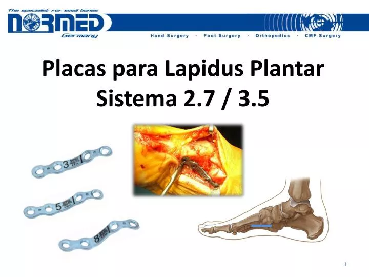 placas para lapidus plantar sistema 2 7 3 5