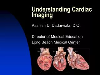 Understanding Cardiac Imaging