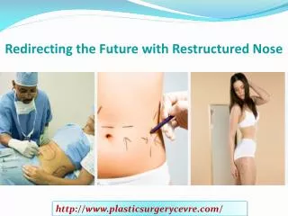 Redirecting the Future with Restructured Nose