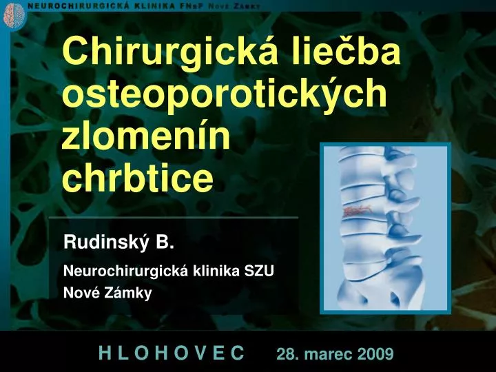 rudinsk b neurochirurgick klinika szu nov z mky