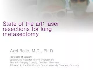 State of the art: laser resections for lung metasectomy