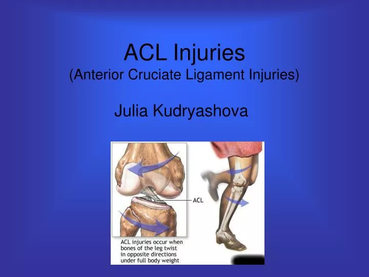 acl injuries anterior cruciate ligament injuries
