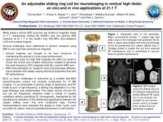 An adjustable sliding ring coil for neuroimaging in vertical high fields:
