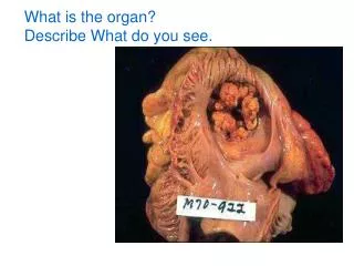 What is the organ? Describe What do you see.