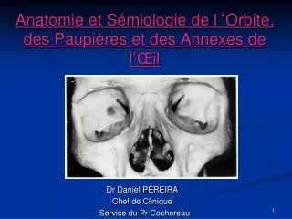 anatomie et s miologie de l orbite des paupi res et des annexes de l il