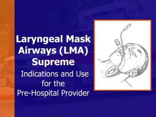 Laryngeal Mask Airways (LMA) Supreme Indications and Use for the Pre-Hospital Provider