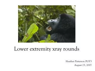 Lower extremity xray rounds