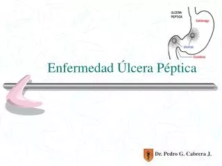 enfermedad lcera p ptica