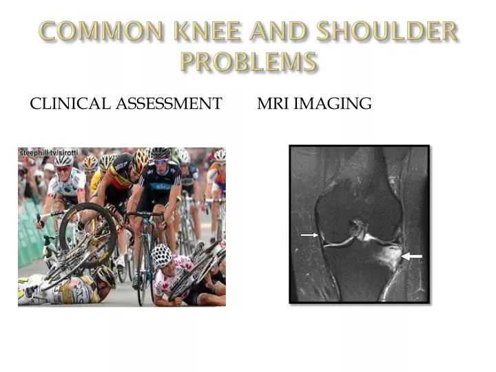 common knee and shoulder problems