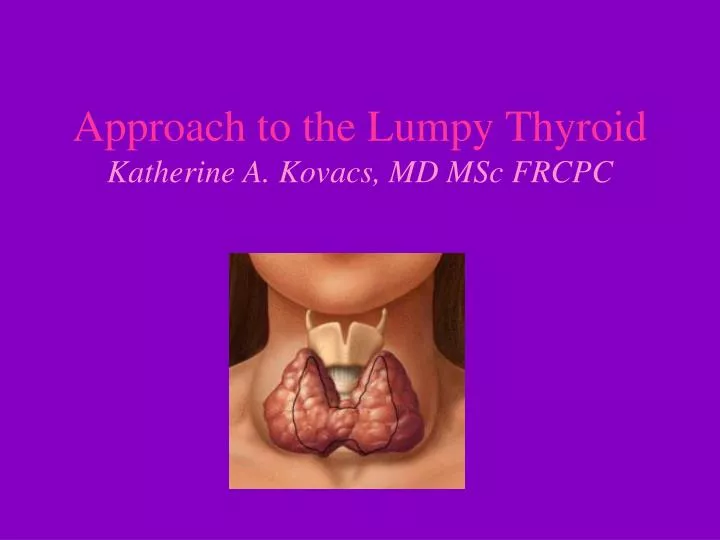 approach to the lumpy thyroid katherine a kovacs md msc frcpc
