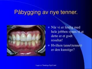 p bygging av nye tenner