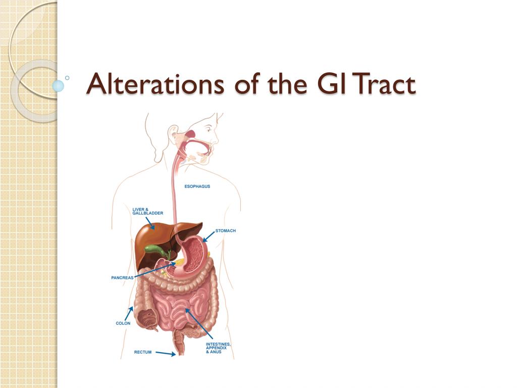 PPT - Alterations of the GI Tract PowerPoint Presentation, free ...