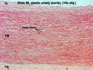 Slide 88, elastic artery (aorta), (10x obj.)