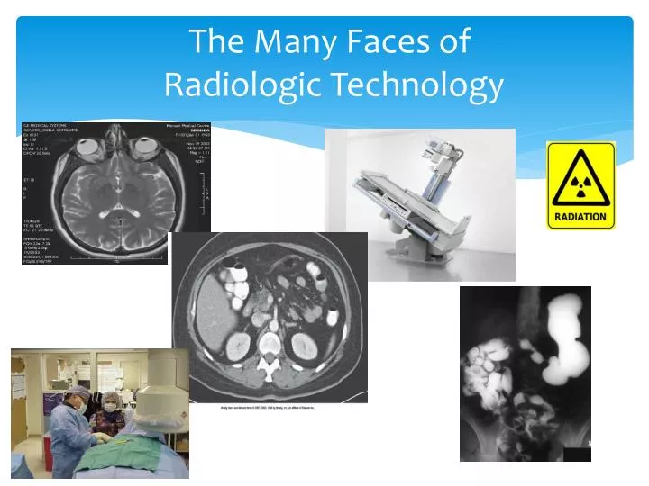 the many faces of radiologic technology