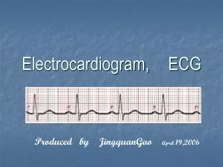 Ppt - Electrocardiogram (ekg Or Ecg) In Jamaica Powerpoint Presentation 