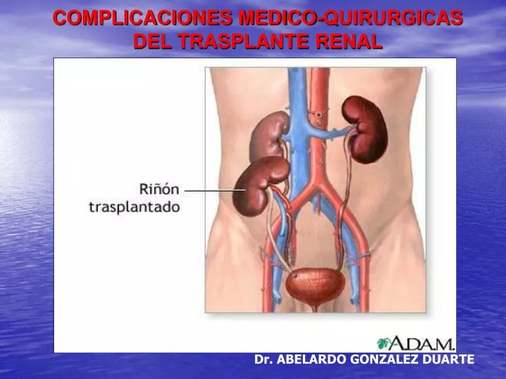 complicaciones medico quirurgicas del trasplante renal