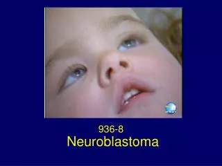 Neuroblastoma