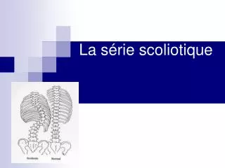 la s rie scoliotique
