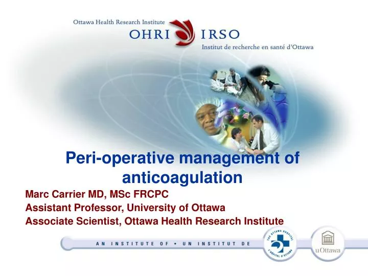 peri operative management of anticoagulation
