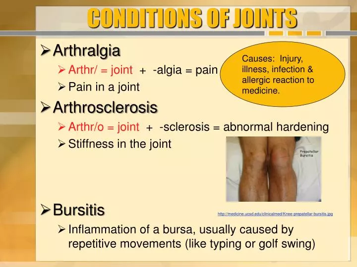 conditions of joints