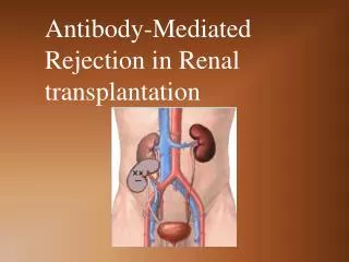 Antibody-Mediated Rejection in Renal transplantation