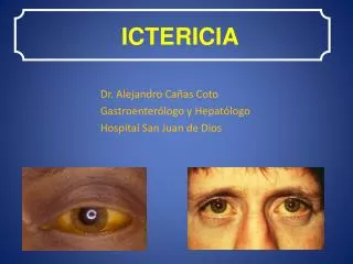 ictericia