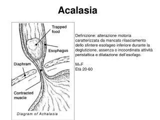 acalasia