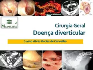cirurgia geral doen a diverticular