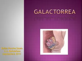 galactorrea