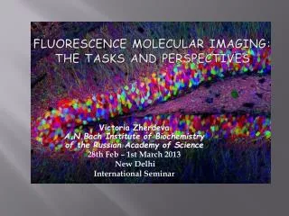 Fluorescence molecular imaging: the tasks and perspectives