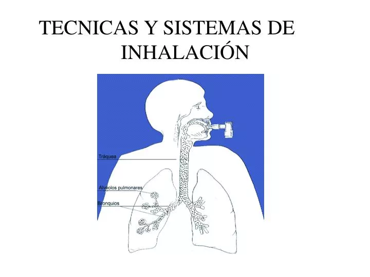 tecnicas y sistemas de inhalaci n