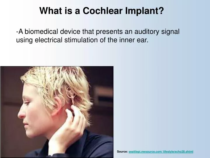 what is a cochlear implant