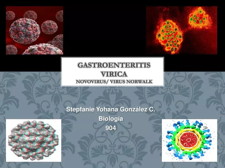 gastroenteritis virica novovirus virus norwalk
