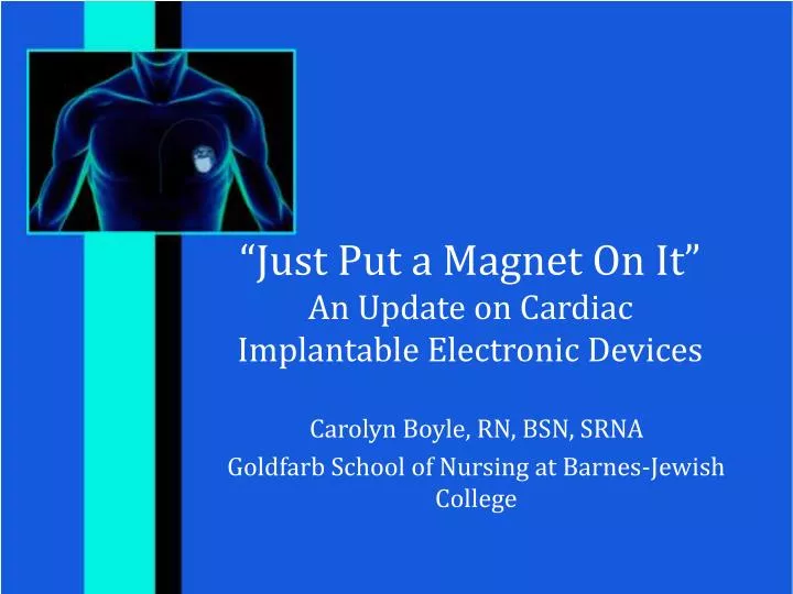 just put a magnet on it an update on cardiac implantable electronic devices