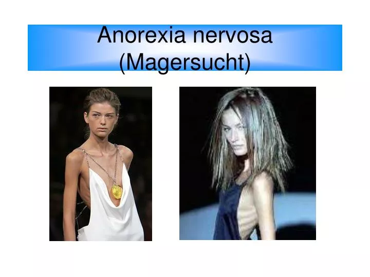 anorexia nervosa magersucht