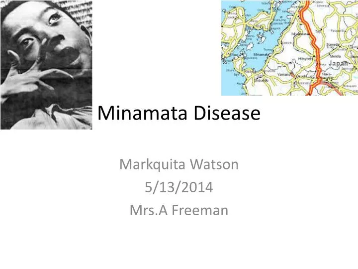 minamata disease