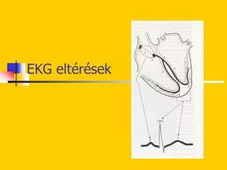 ekg elt r sek
