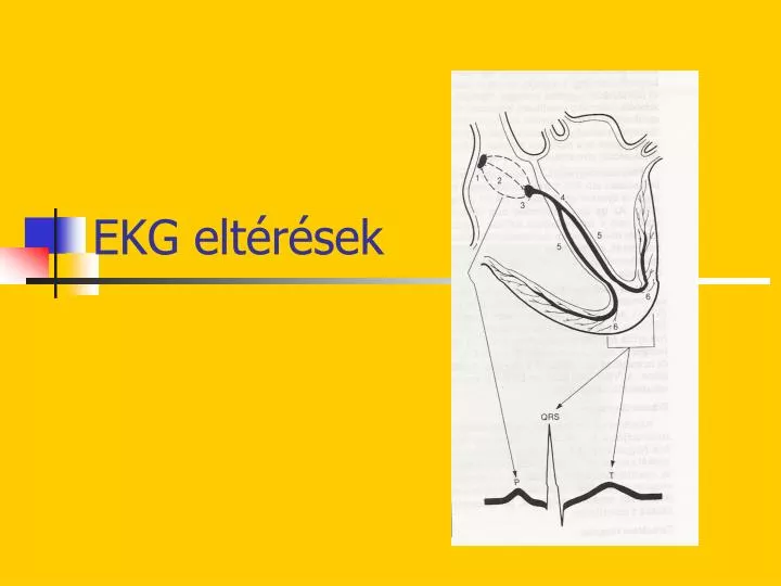 ekg elt r sek