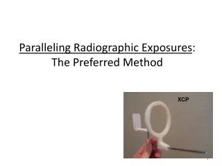 Paralleling Radiographic Exposures : The Preferred Method