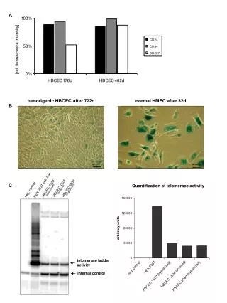 tumorigenic HBCEC after 722d