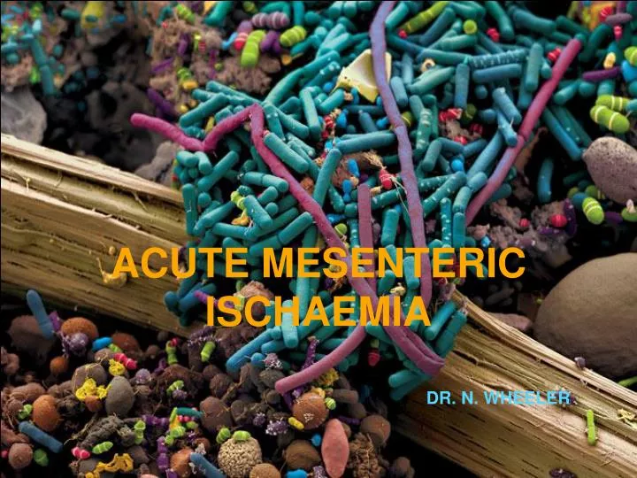 acute mesenteric ischaemia